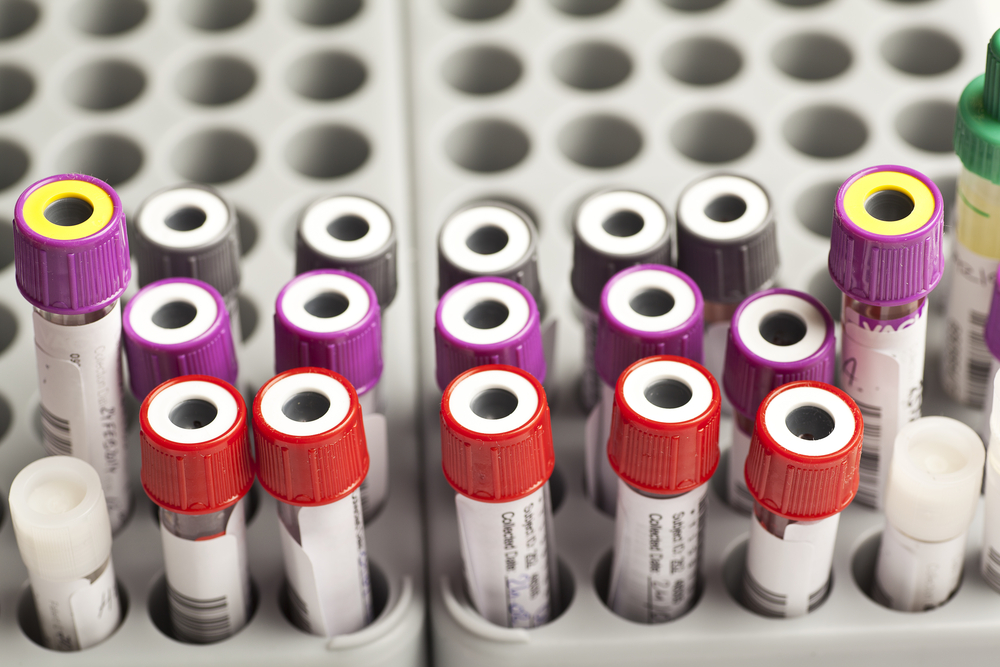 Blood test vials used for veterinary diagnostics at Oliver Animal Hospital in Austin