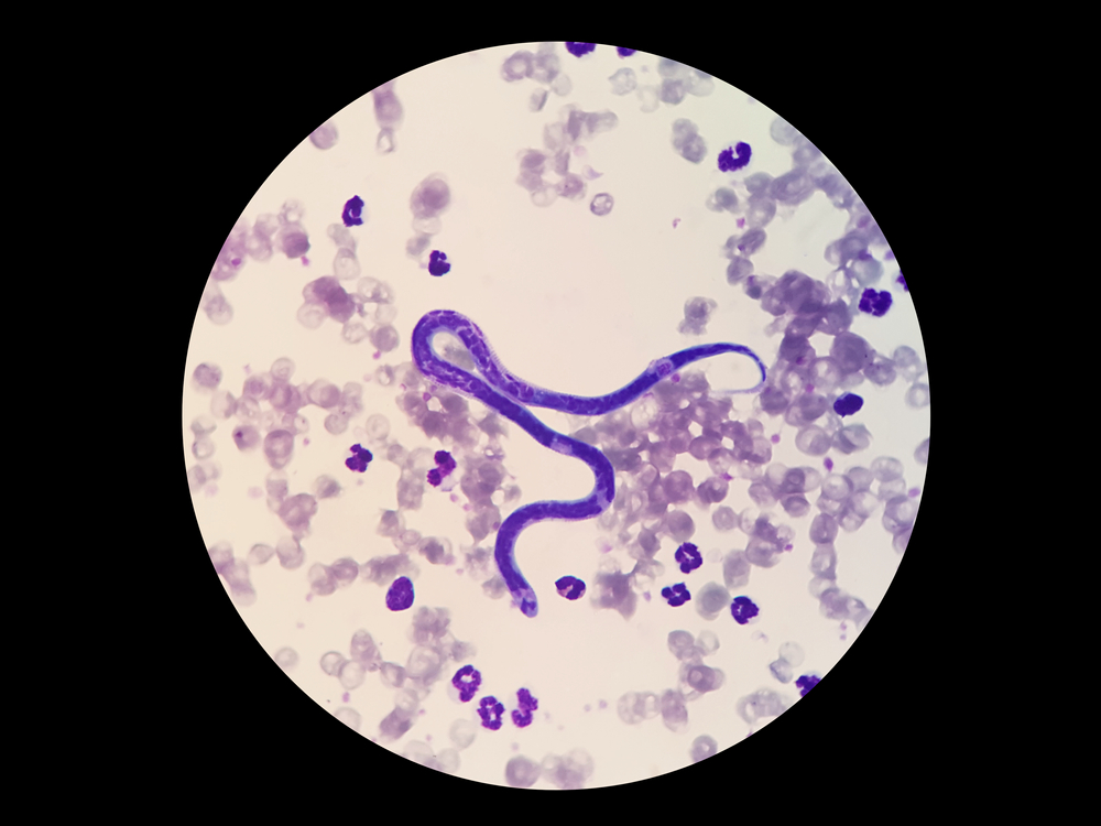 Microscope view of microfilariae in a dog's blood smear, used in heartworm disease diagnosis